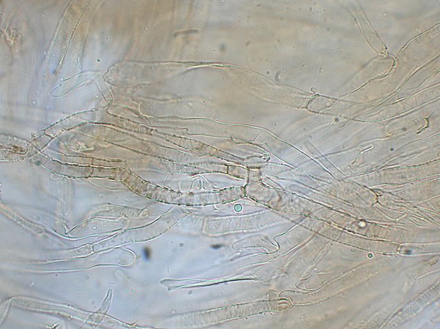 Inocybe asterospora   Qulet
